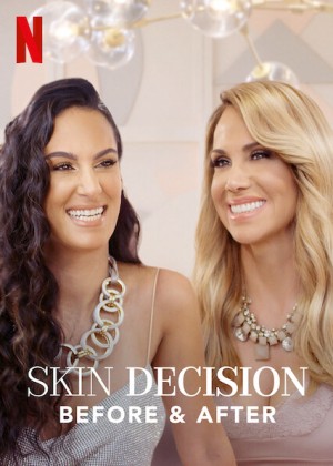Lựa chọn lột xác: Trước và sau Skin Decision: Before and After